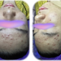 Top 10 Spa Chăm Sóc Da Uy Tín