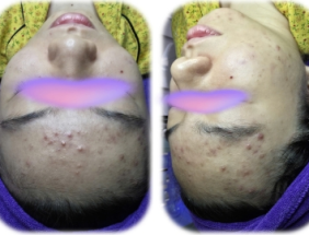 Top 10 Spa Chăm Sóc Da Uy Tín
