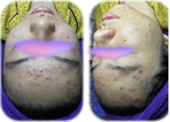 Top 10 Spa Chăm Sóc Da Uy Tín